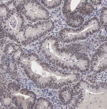 POLR2F Antibody - BSA Free
