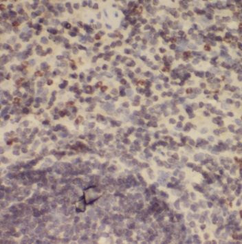 DNA polymerase mu Antibody - BSA Free
