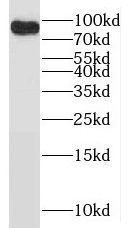DNA Polymerase iota Antibody - BSA Free