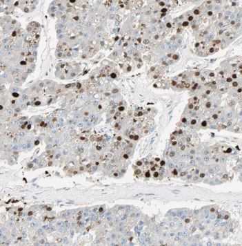 DNA Polymerase iota Antibody - BSA Free