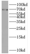 POF1B Antibody - BSA Free