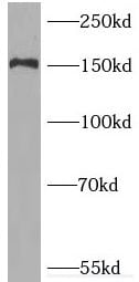 PNPLA6 Antibody - BSA Free