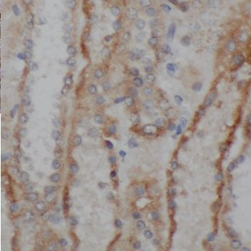 PNLDC1 Antibody - BSA Free