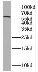 PNLDC1 Antibody - BSA Free