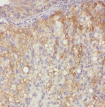 PNCK Antibody - BSA Free