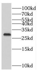 PMM1/Phosphomannomutase 1 Antibody - BSA Free