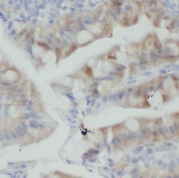 PLS1 Antibody - BSA Free