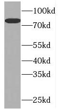 PLK2 Antibody - BSA Free