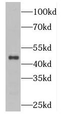 CKIP-1 Antibody - BSA Free