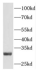 APPD Antibody - BSA Free
