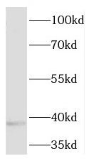 Pleckstrin-2 Antibody - BSA Free