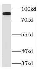 Phospholipase C delta 1 Antibody - BSA Free