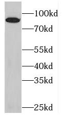 Plakophilin-3 Antibody - BSA Free
