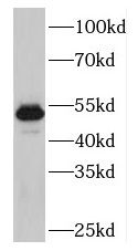 PLAGL1 Antibody - BSA Free