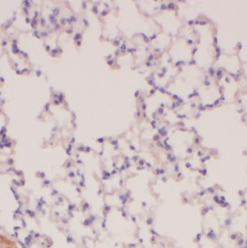 PLA2G4F Antibody - BSA Free