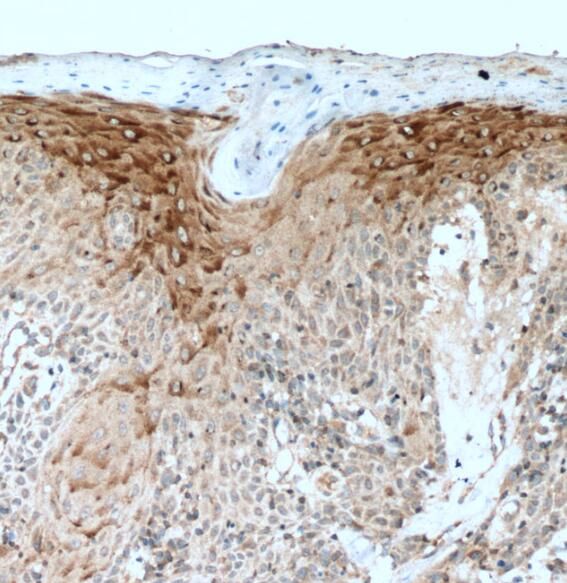 PLA2G4D Antibody - BSA Free