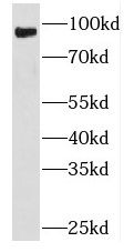PLA2G4D Antibody - BSA Free