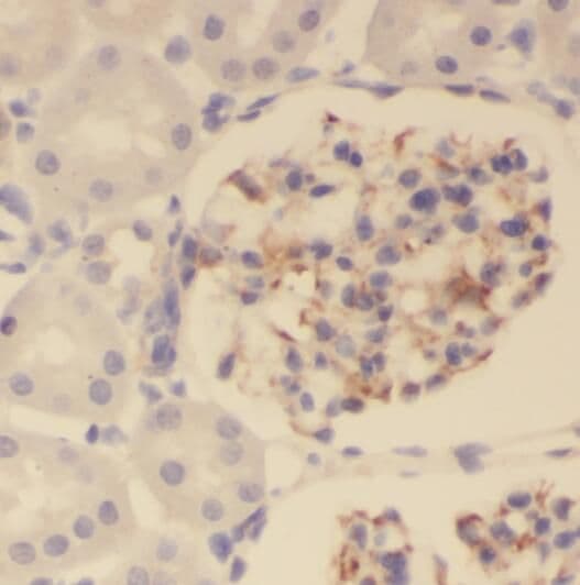 PKNOX2 Antibody - BSA Free