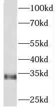 PITPN Antibody - BSA Free