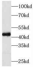 PIP5KL1 Antibody - BSA Free