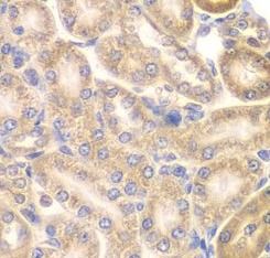 PIP5K2 alpha Antibody - BSA Free