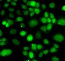 PIP5K2 alpha Antibody - BSA Free