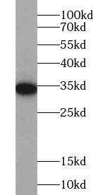 PIK3IP1 Antibody - BSA Free