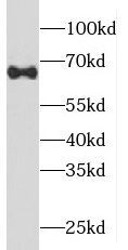 PIGT Antibody - BSA Free