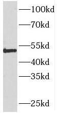 PIGM Antibody - BSA Free