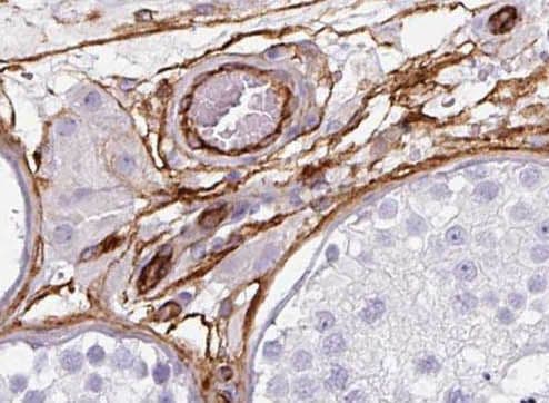 PIGM Antibody - BSA Free