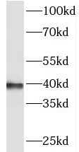 PHYHIPL Antibody - BSA Free