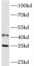 PHYHIP Antibody - BSA Free