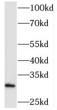 PHYHD1 Antibody - BSA Free