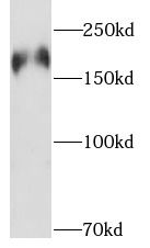 PHLPP Antibody - BSA Free