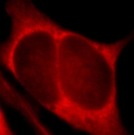 PHLPP Antibody - BSA Free