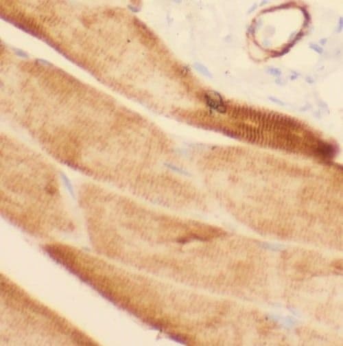 Phosphorylase B Antibody - BSA Free