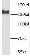 PHKA2 Antibody - BSA Free