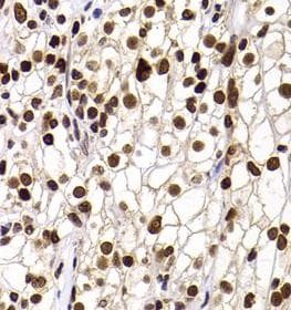 PHIP Antibody - BSA Free