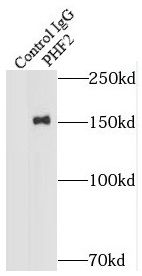 PHF2 Antibody - BSA Free