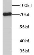PGM2L1 Antibody - BSA Free