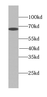 PEX5L Antibody - BSA Free