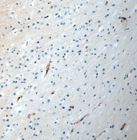 PEX5L Antibody - BSA Free