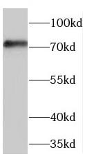 Pescadillo Antibody - BSA Free