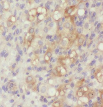 Pellino 2 Antibody - BSA Free