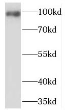 PDE6 beta Antibody - BSA Free