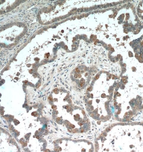 PDE6A Antibody - BSA Free