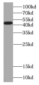 PCYT1B Antibody - BSA Free