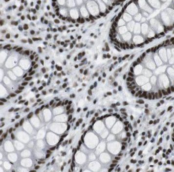 PCYOX1 Antibody - BSA Free