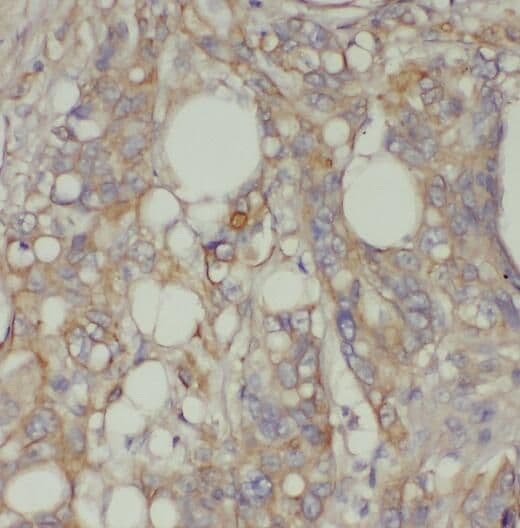 Proprotein Convertase 7/PCSK7 Antibody - BSA Free