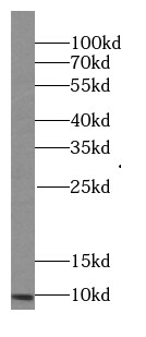 IQM1 Antibody - BSA Free